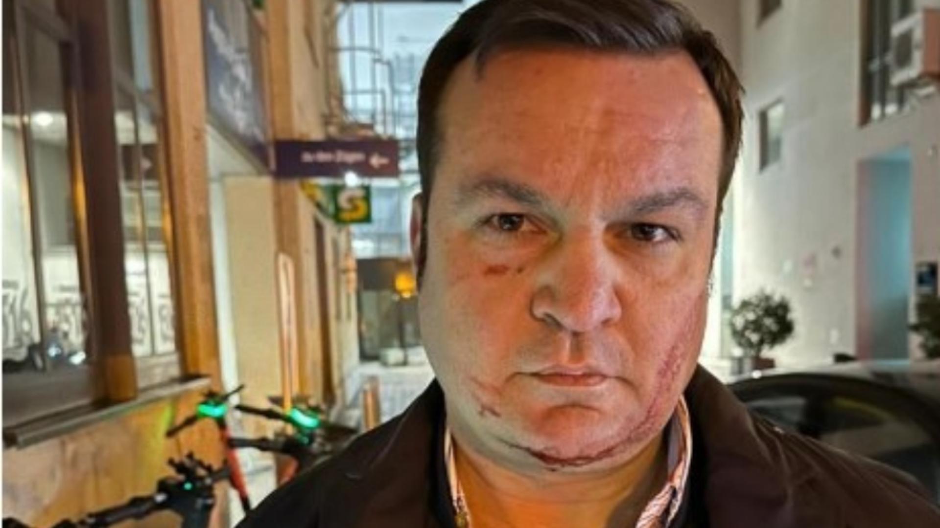Cum explică Cătălin Cherecheș sângele de pe față din momentul reținerii